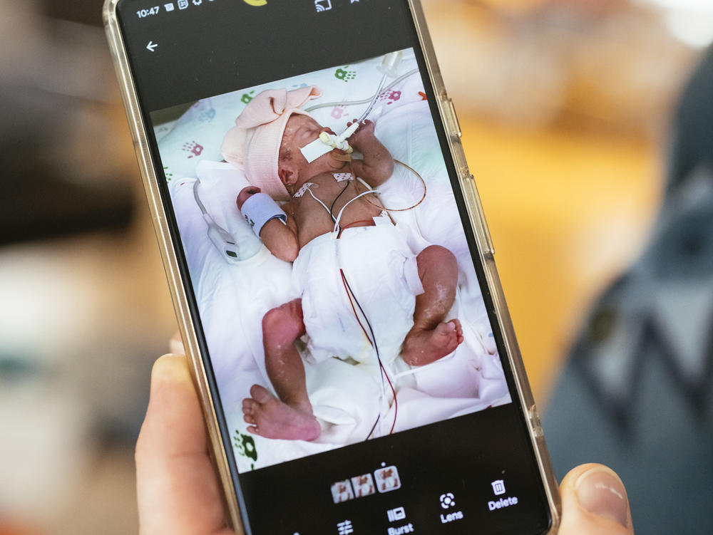 Casey Trumble shows a photo of his daughter, Joey, after her premature birth in 2019. Her parents later learned she was treated in her Chicago hospital's NICU by out-of-network neonatologists from the children's hospital next door.