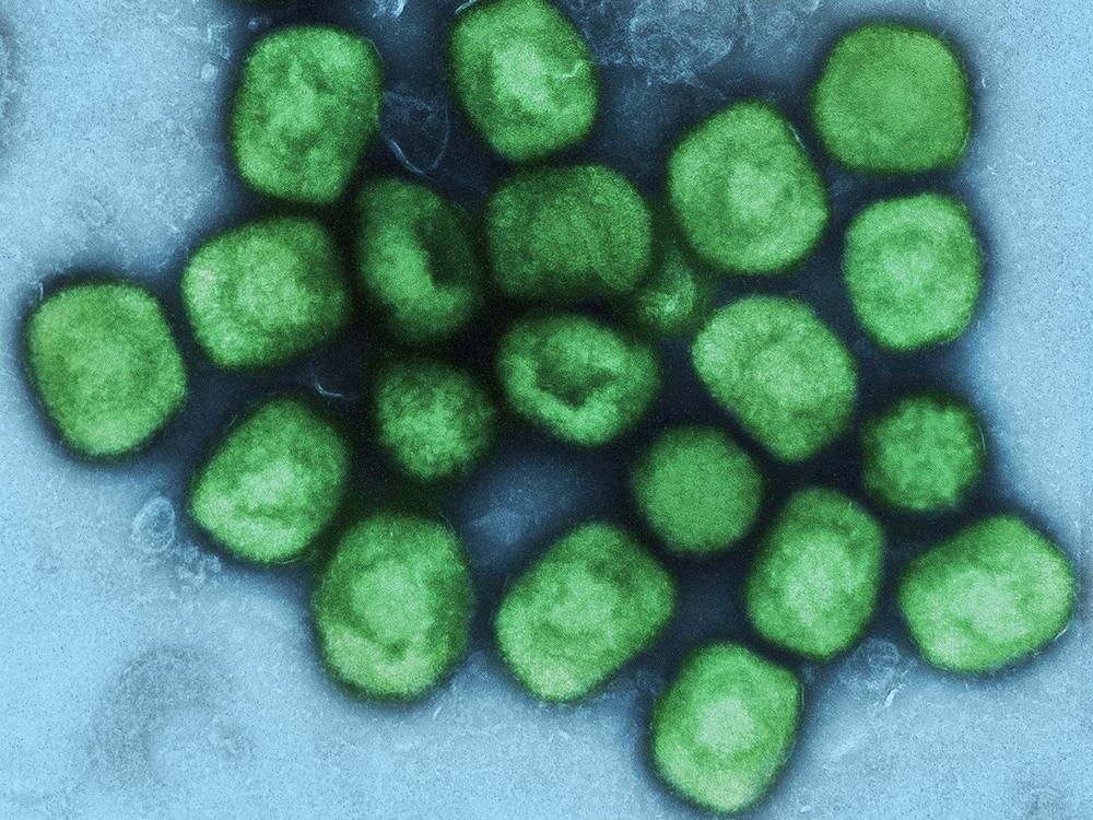 This image shows purified particles of mpox virus, formerly called monkeypox. Viruses like these can be genetically altered in the lab in ways that might make them more dangerous.