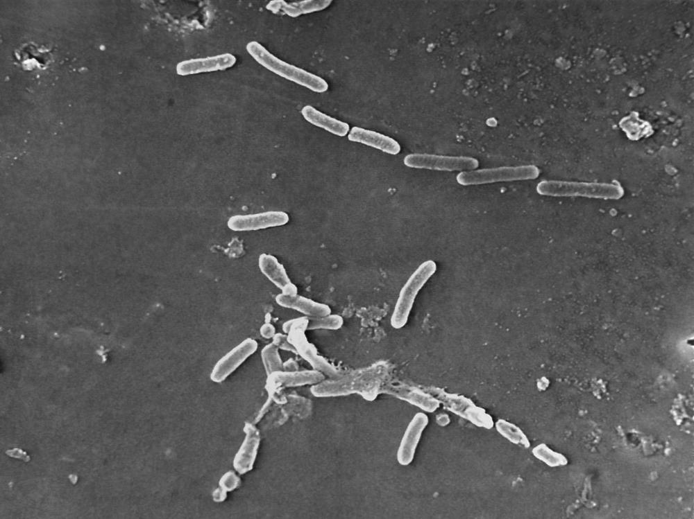 This scanning electron microscope image made available by the Centers for Disease Control and Prevention shows rod-shaped Pseudomonas aeruginosa bacteria. U.S. health officials are advising people to stop using the over-the-counter eye drops, EzriCare Artificial Tears, that have been linked to an outbreak of drug-resistant infections of Pseudomonas aeruginosa.