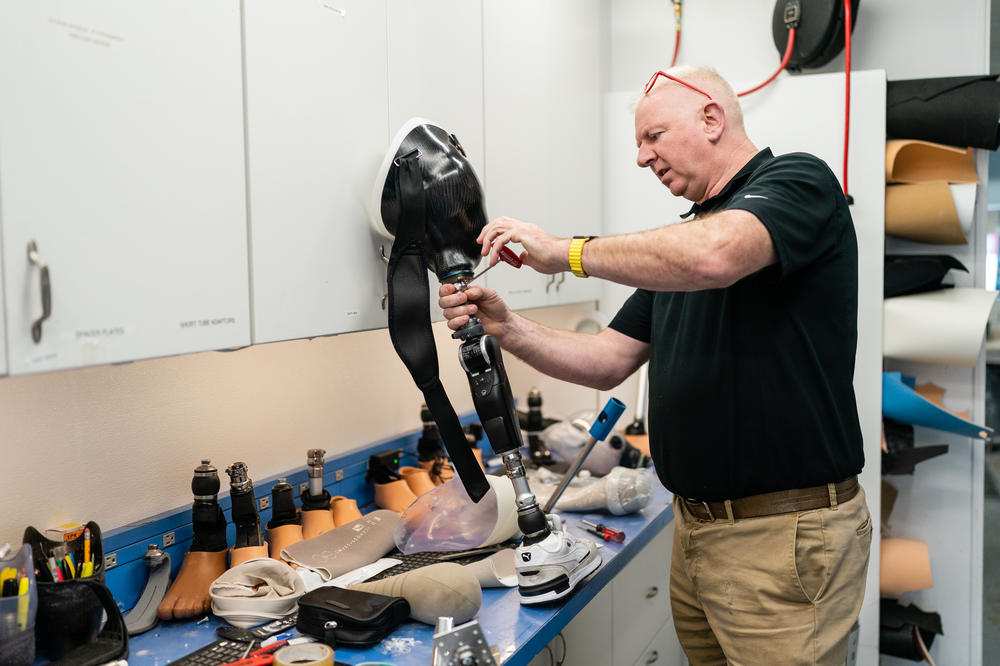 Mike Corcoran, a hip disarticulation and hemipelvectomy specialist, works on Oleksandr Fedun's prosthesis at Medical Center Orthotics & Prosthetics (MCOP) in Silver Spring, Md.