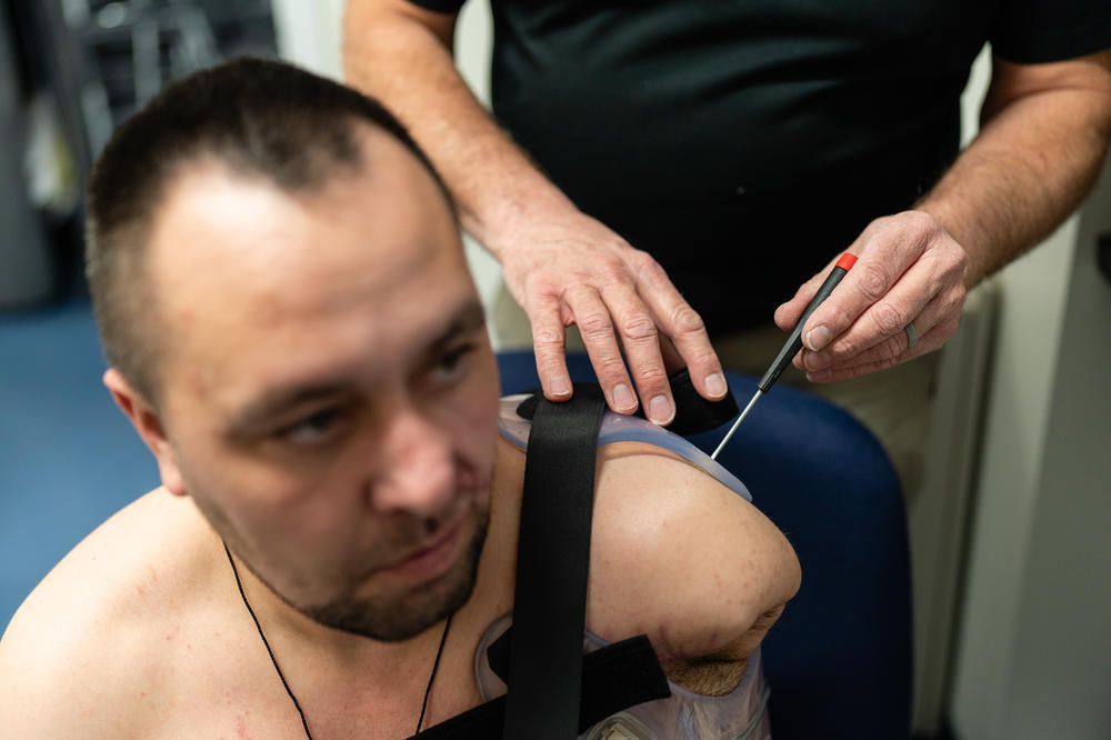 Jamie Vandersea, upper extremity prosthetics specialist, adjusts the sensitivity of sensors on a socket that Ukrainian soldier Roman Rodionov is wearing.