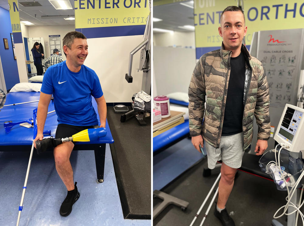 Ruslan Tyshchenko, a Ukrainian sapper, says the first thing he wanted to do when he got his prosthesis was sit with his legs crossed. Dmytro Sklyarenko, an infantryman, also lost his leg high above the knee and came to MCOP to get a new 