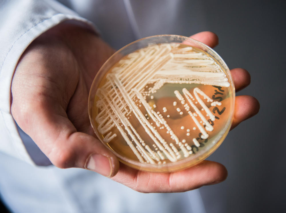 A researcher holds a petri dish with the Candida auris in a laboratory in Wuerzburg University in 2018.