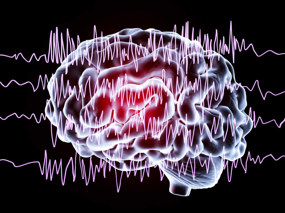 If the brain is a musical instrument, 