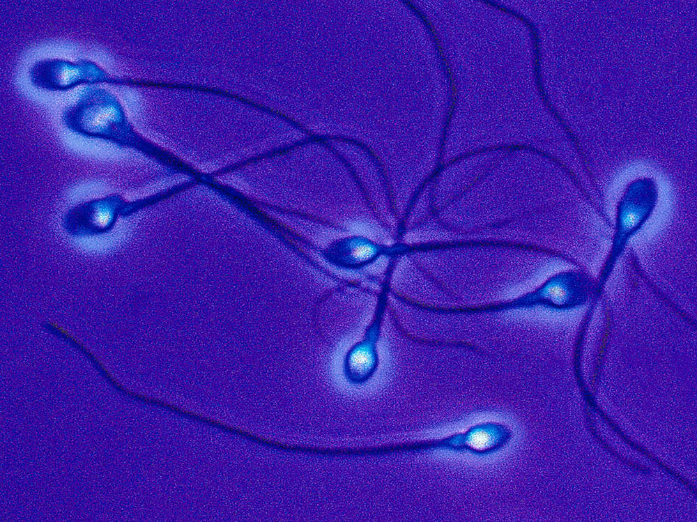 Researchers are testing a promising approach to male contraception, one that involves immobilizing sperm.
