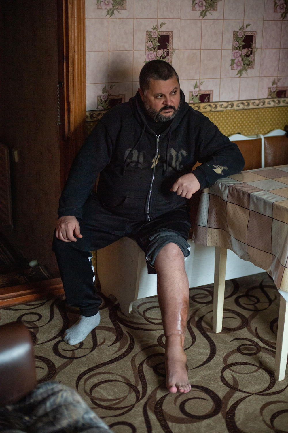 Oleksandr Diakov, a Kherson resident, sits in his home and shows scars on his leg from when he was tortured by Russian soldiers during the occupation of the city.