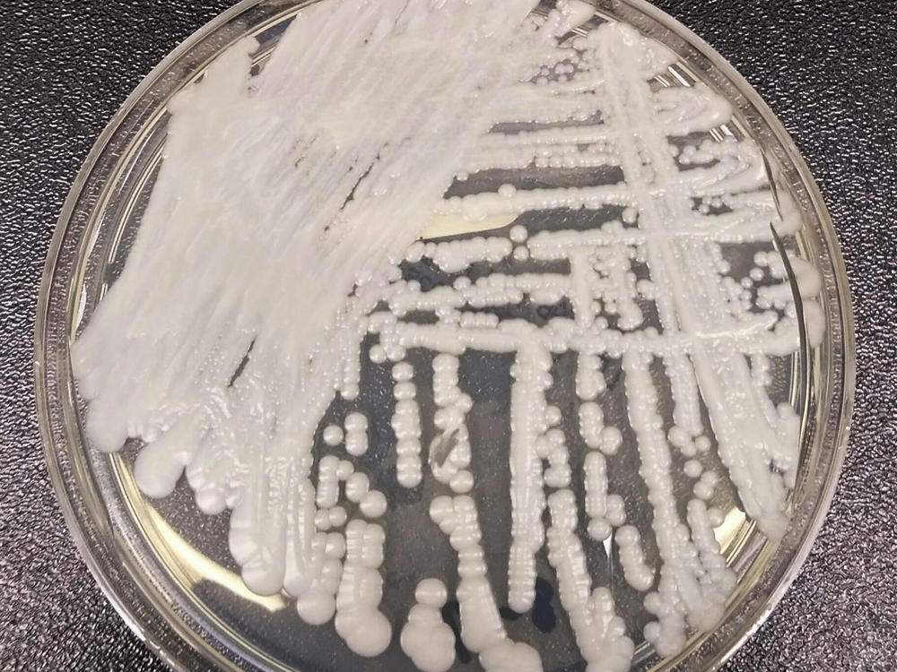 This undated photo made available by the Centers for Disease Control and Prevention shows a strain of Candida auris cultured in a petri dish.