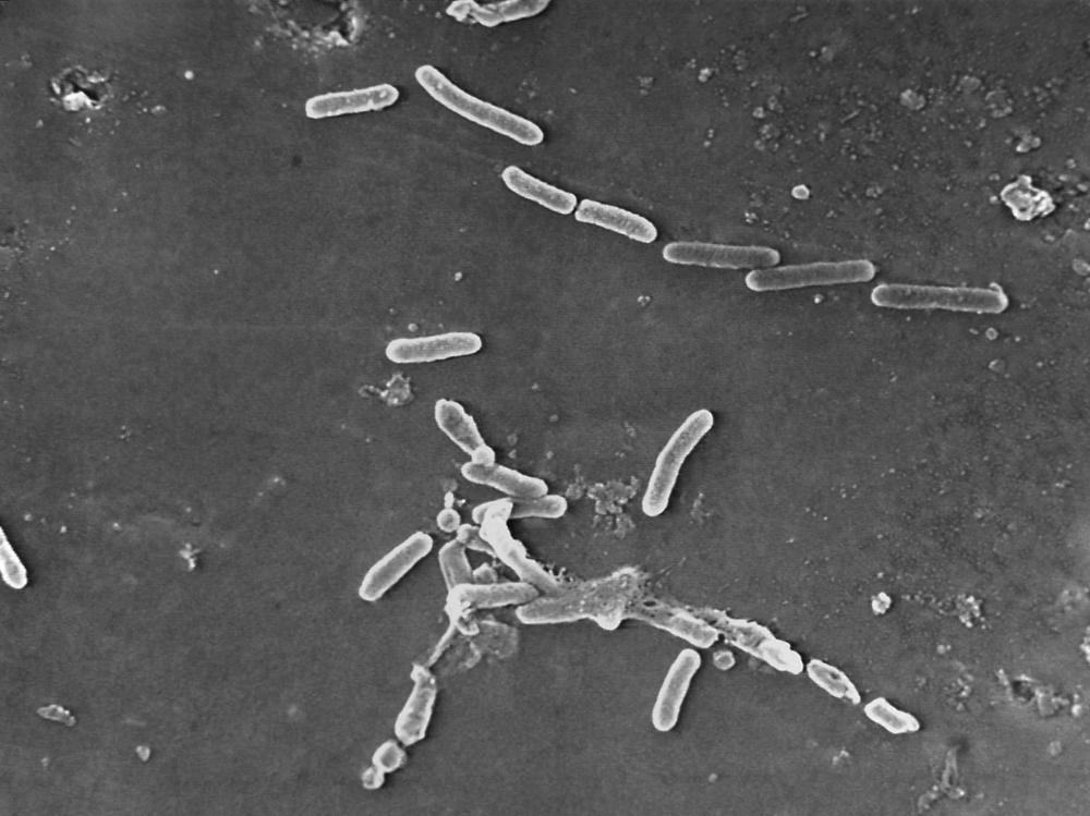 Pseudomonas aeruginosa bacteria as seen under a microscope. The Centers for Disease Control and Prevention says 68 people have become infected with a drug-resistant strain of the bacteria, with many infections linked to the use of contaminated eye drops.