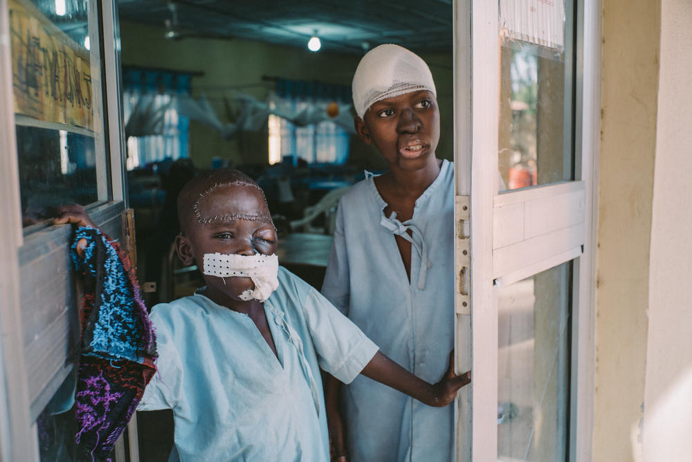 Umar, an 8-year-old noma patient, and Adamu, a 15-year-old noma patient, at the entrance of the post-operative ward at Sokoto Noma Hospital. The two boys both underwent surgery there and were confined to that ward for weeks to avoid infections.