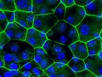 Microscope images of urinary tract cells from mice that were not given a UTI (naive) and those that were susceptible to recurrent UTIs (sensitized). Cells are outlined in green and the DNA in each cell glows blue. The cells susceptible to recurrent UTIs are smaller.