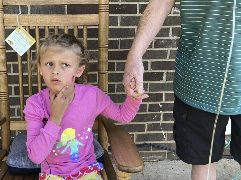 Kinsley White, 6, shows reporters her wound on Thursday in Gastonia, N.C.