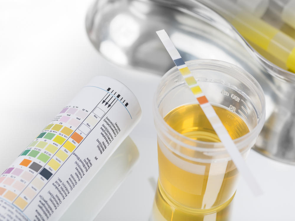 Some urinary tract infections may be caused by food-borne <em>E. coli</em> bacteria, research finds.