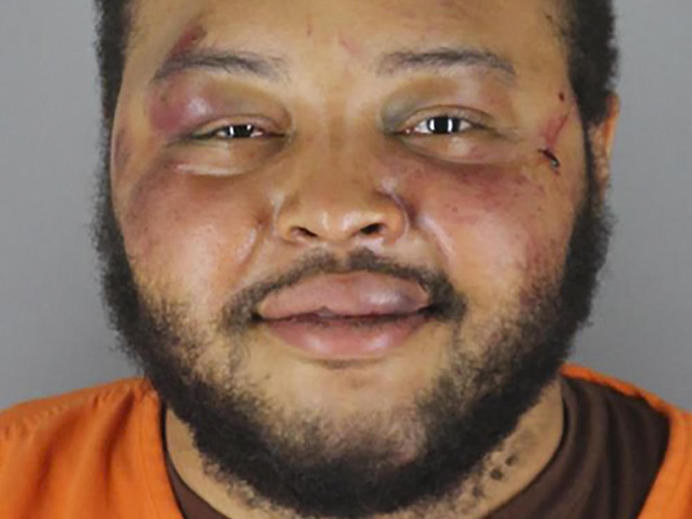 Jaleel Stallings said he fired at officers in self-defense — and after he surrendered, he was badly beaten. A former officer pleaded guilty to a felony charge in the case on Wednesday.