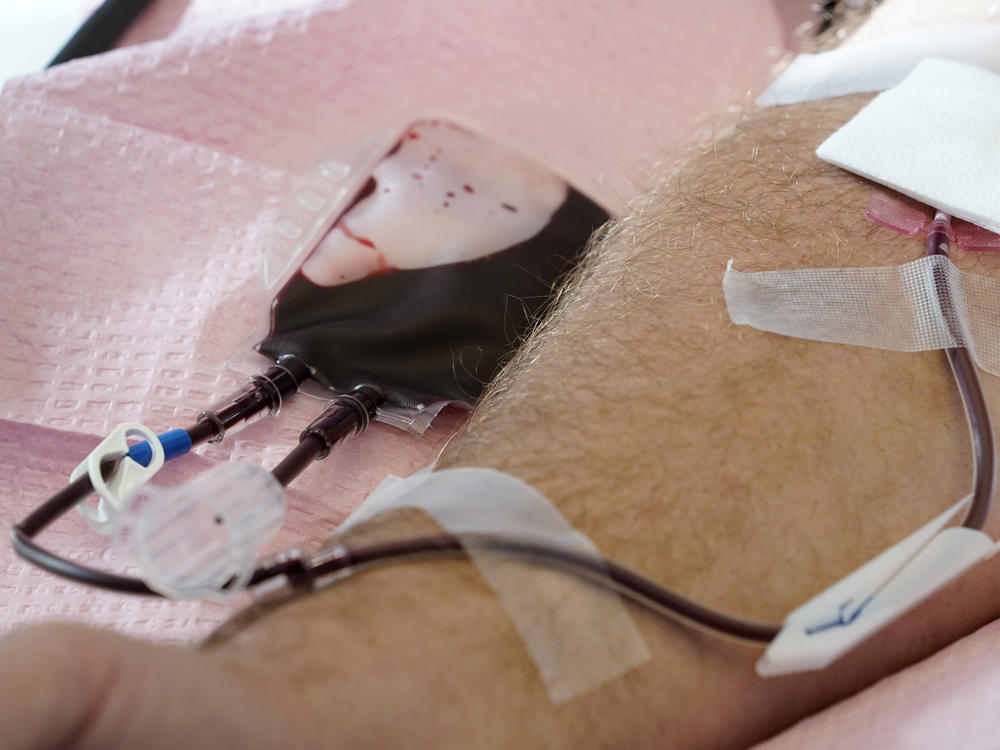 The U.S. is moving to ease restrictions on blood donations from gay and bisexual men and other groups that traditionally face higher risks of HIV. Here, tubes direct blood from a donor into a bag in Davenport, Iowa, on Friday, Nov. 11, 2022.