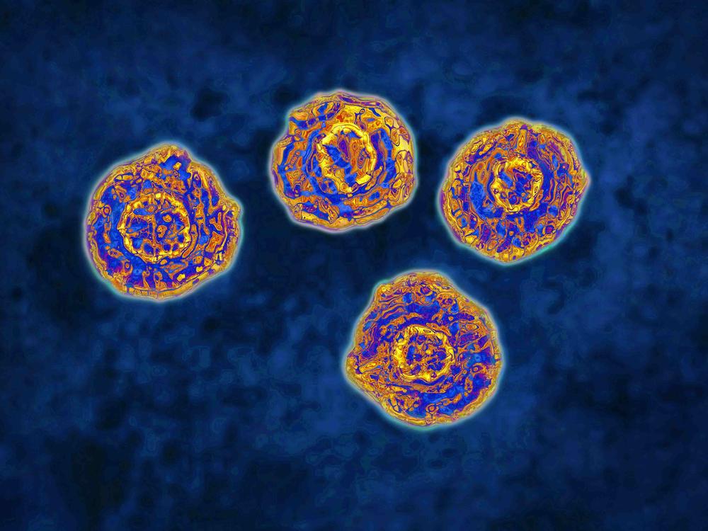 Hepatitis C can cause severe liver damage and leads to about 15,000 deaths in the U.S. each year.