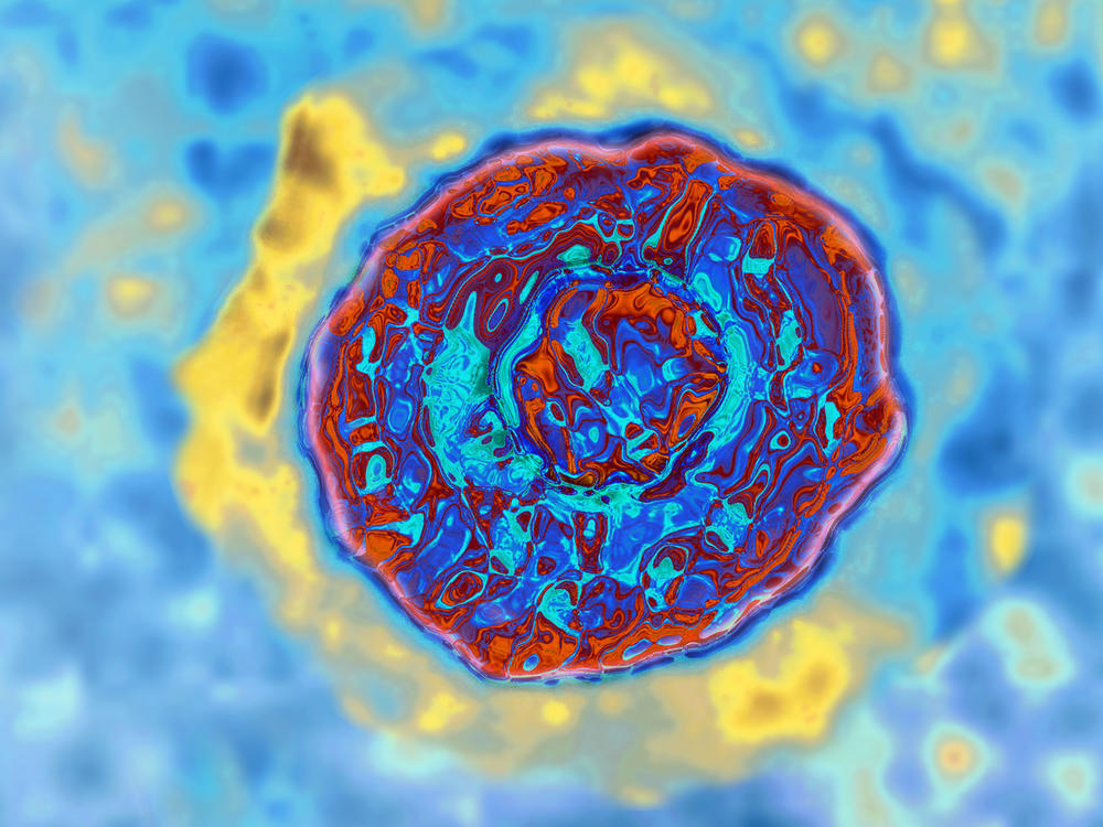 An image of the hepatitis C virus  Image made from a transmission electron microscopy. The virus is adept at evading the immune system.