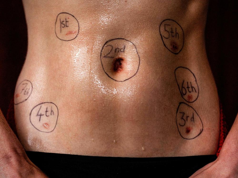 <em>Below the Belt</em> is a documentary about endometriosis.