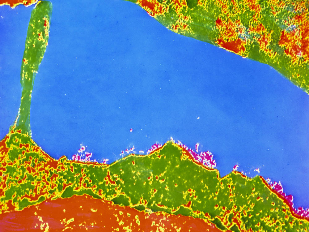 This colorized transmission electron micrograph of a human white blood cell (bottom) shows the HLA antigen — the uneven red areas on the cell's exterior surface. A variant of the HLA gene could play a role in warding off COVID symptoms.