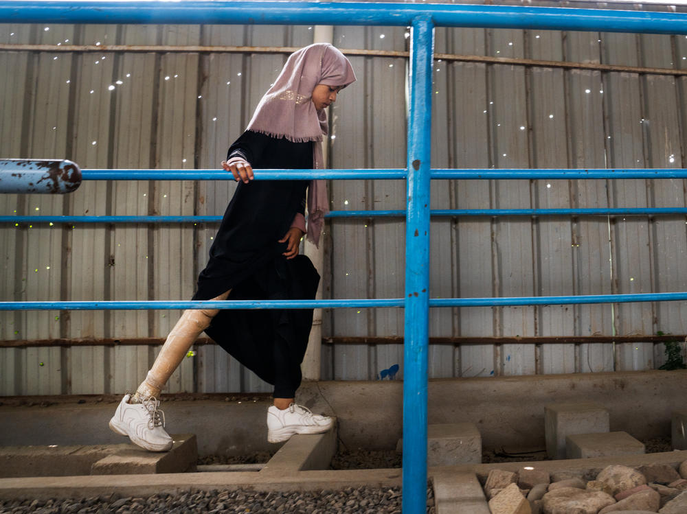 Shaimaa Ali Ahmed, 12, lost her leg at age 6 after happening upon an unexploded rocket. Yemeni children like her bear an outsized burden from the civil war, where land mines and ordnance litter the landscape.