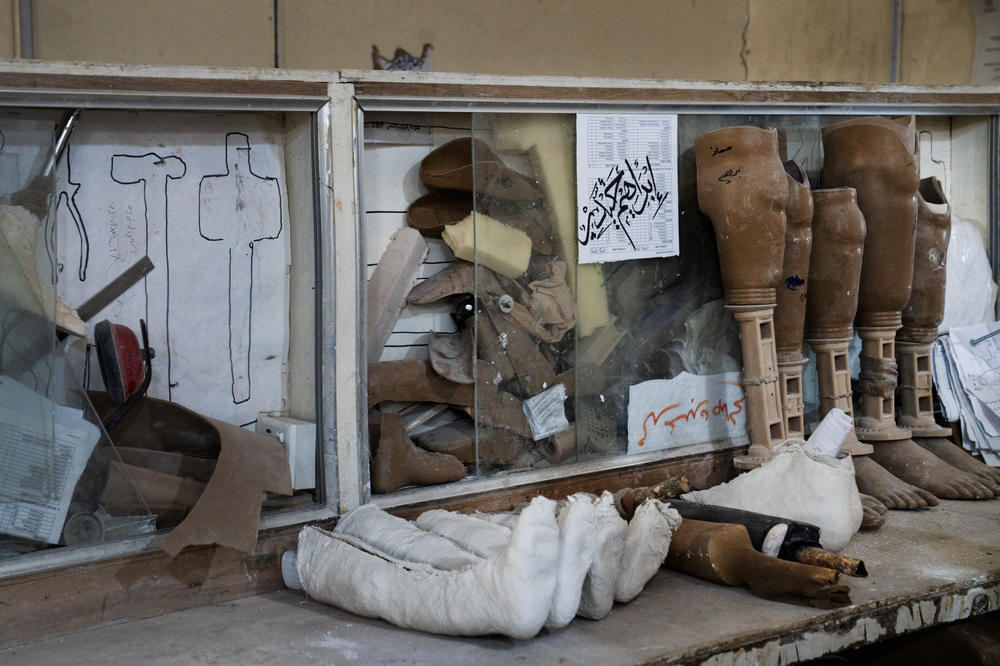 Prosthetic limbs in various stages of construction line a work bench at the prosthetics center.