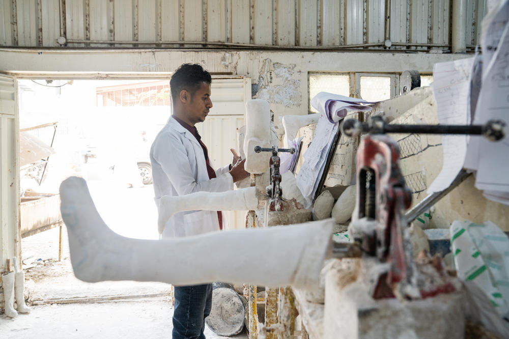 The prosthetics center in the frontline city of Taiz sees hundreds of new patients each year, requiring a range of different types of limbs.