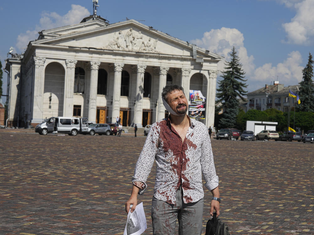An injured man walks in Krasna Square in front of the Taras Shevchenko Chernihiv Regional Academic Music and Drama Theatre, after a Russian attack on Chernihiv, Ukraine, on Saturday.