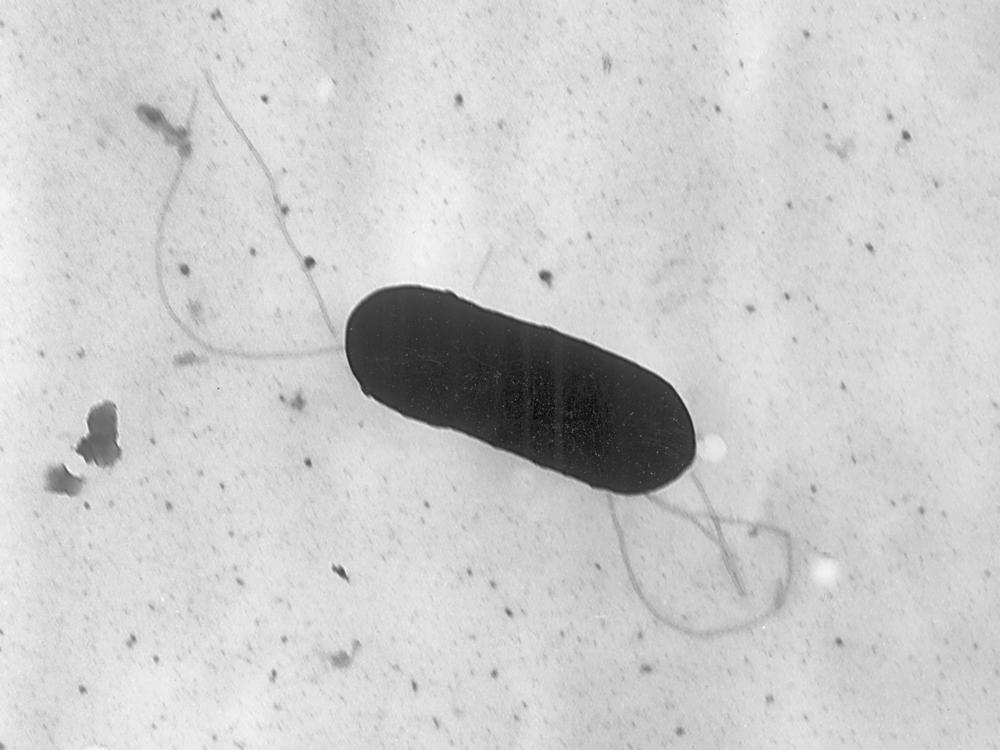 A listeria bacterium seen under an electron microscope. Listeria is not typically life-threatening, but those over 65, pregnant or with compromised immune systems are deemed high-risk when exposed to the bacteria.