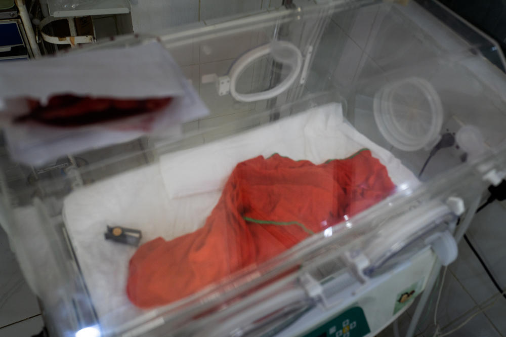 A baby born to a severely malnourished mother has died from complications. The newborn is covered with a blanket in the neonatal unit.