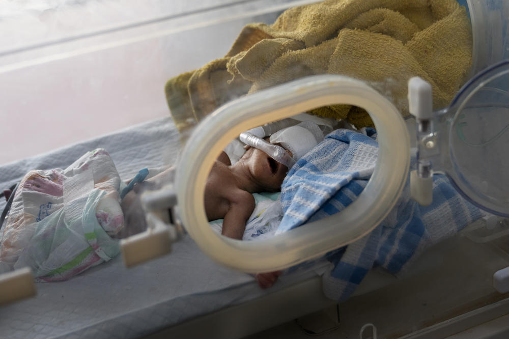 A baby is being treated for malnutrition in the neonatal department at Al-Sadaqa hospital in Aden, Yemen. The unit is filled with newborns born with complications due to malnutrition. Doctors say they do not have enough equipment or beds treat the number of babies.