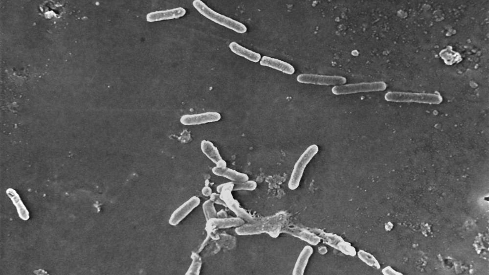 Pseudomonas aeruginosa bacteria as seen under a microscope. The Centers for Disease Control and Prevention says 68 people have become infected with a drug-resistant strain of the bacteria, with many infections linked to the use of contaminated eye drops.