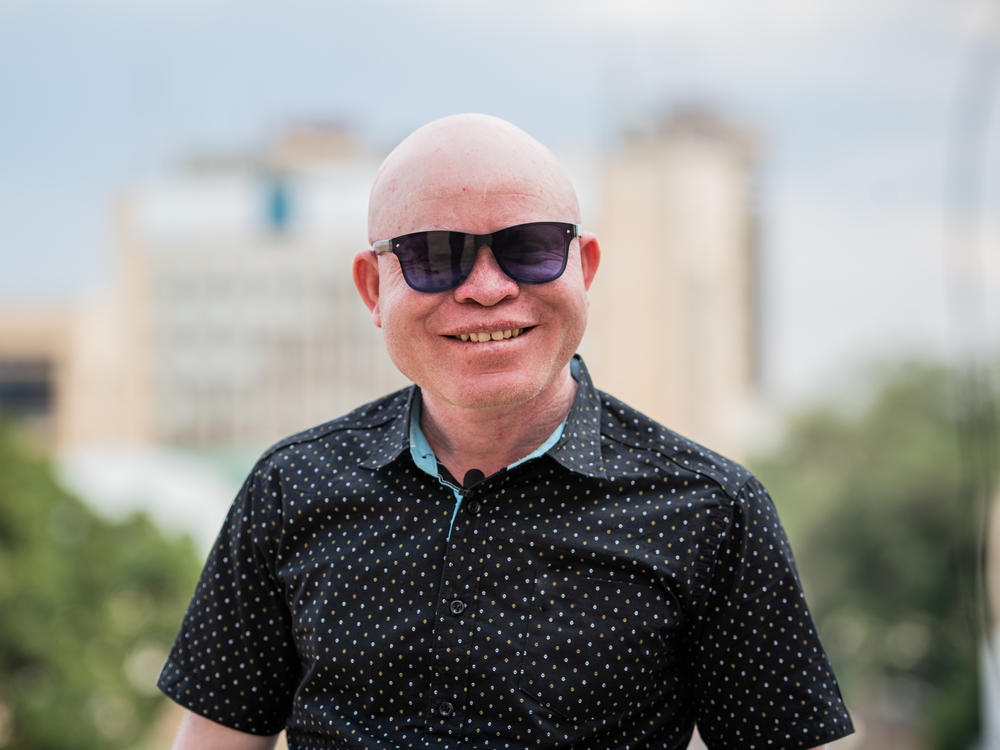 John Chiti is a Zambian musician and police commissioner. He also has albinism, a pigmentation condition that has shaped his life. His story inspired the film 
