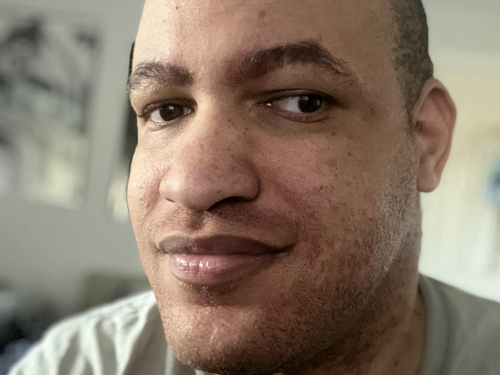 Jon Hetherington, 34, from Oregon, originally planned to attend the Seattle show of Beyoncé's Renaissance World Tour, but couldn't fly because his wheelchair exceeded the plane's cargo dimensions. He posted about the saga on TikTok and a representative for Beyoncé arranged for him to attend her Dallas show.