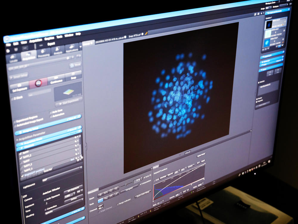 Mouse egg cells glow on the computerized display of a microscope in Katsuhiko Hayashi's lab at Osaka University.