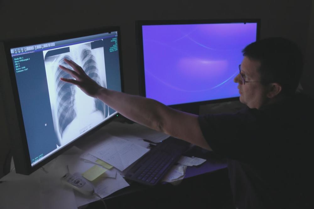 Dr. Brandon Crum reviews X-rays of coal miners with severe black lung disease at his clinic in Pikeville, Ky.