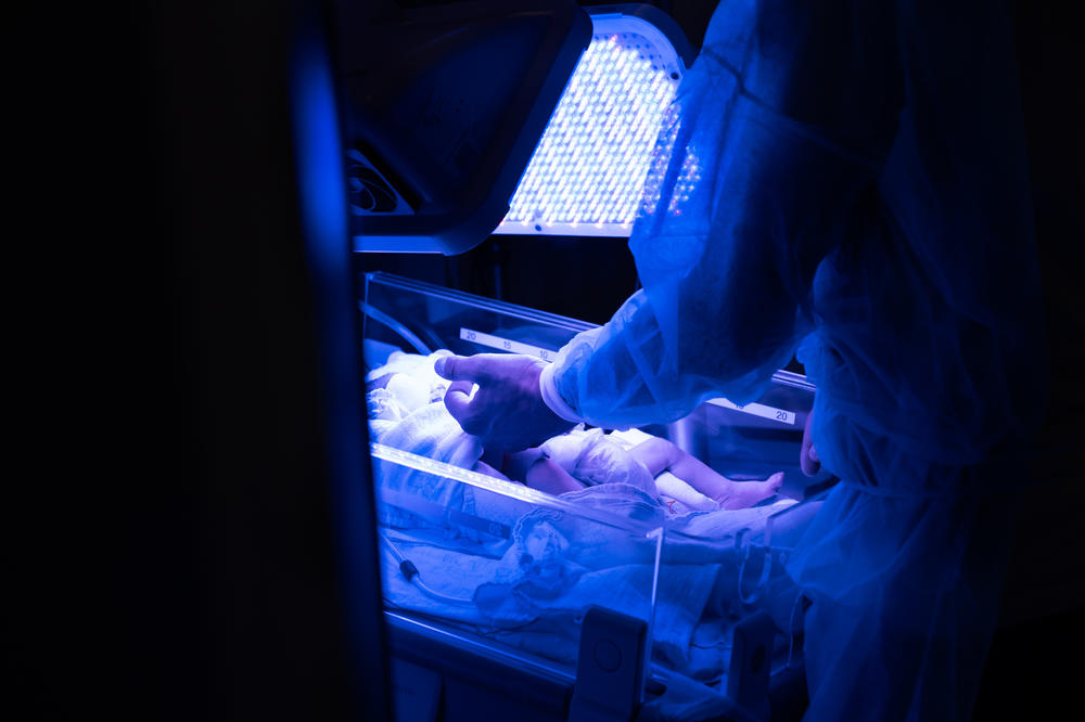 A father visits his baby who is being treated for jaundice in the NICU at Galilee hospital in Nahariya.
