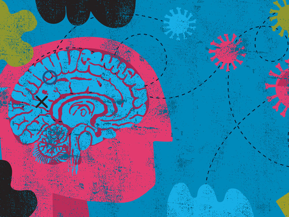 Scientists are learning more about how long COVID affects the brain.