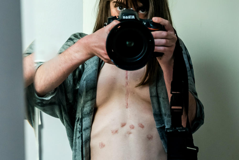 Kathleen Sheffer took this self-portrait, which appears in <em>Artists Remaking Medicine</em>, while she was healing from a heart-lung transplant. She took the image in 2017, 245 days after her surgery.