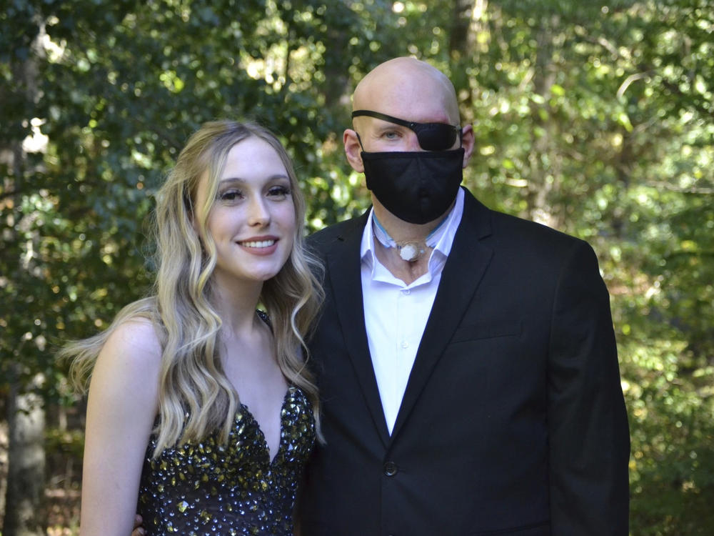 This family photo shows Aaron James and his daughter, Allie in September 2022. Aaron was working for a power line company in June 2021 when he was shocked by a live wire. He nearly died. Ultimately he lost his left arm, requiring a prosthetic. His damaged left eye was so painful it had to be removed.