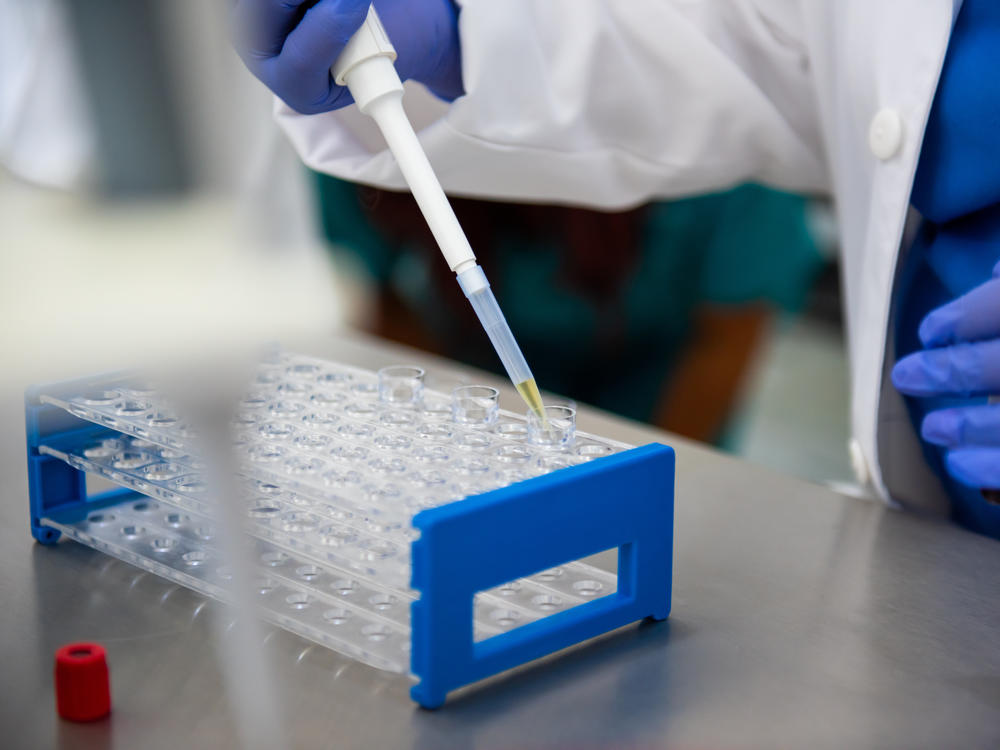Preliminary results from a study show that gene-editing technology can be used to successfully treat a genetic disorder that increases the risk of heart disease.