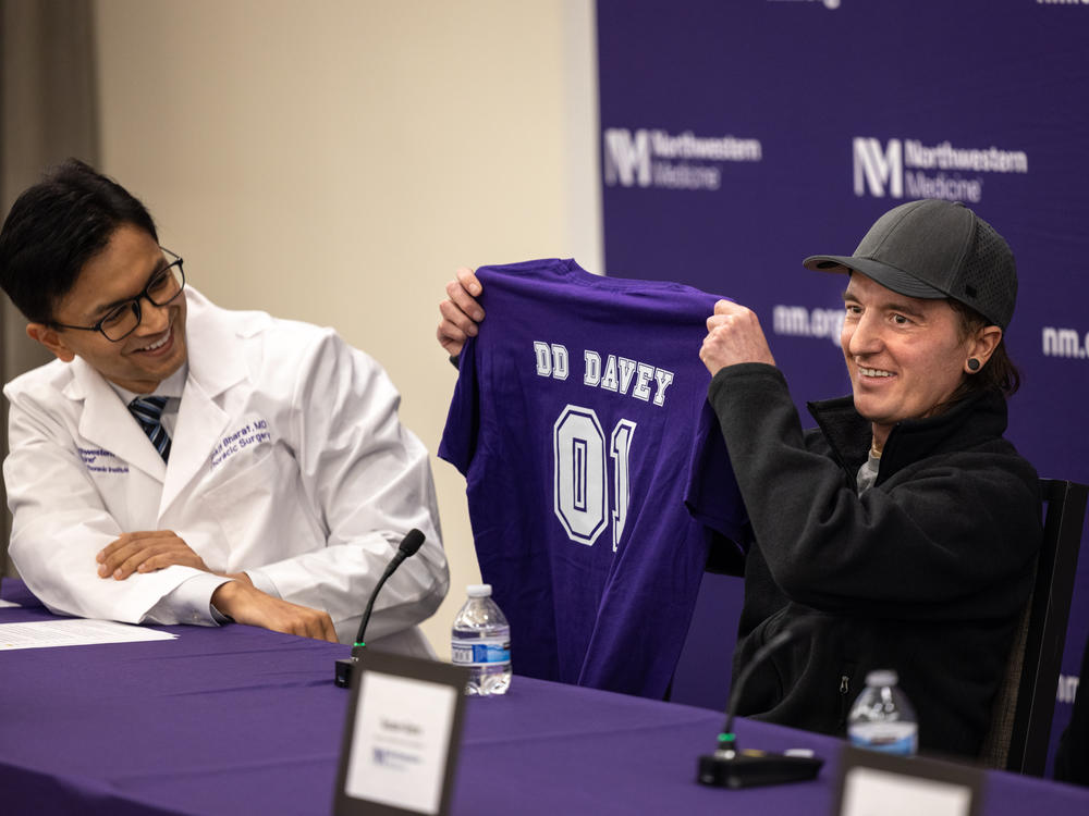 Dr. Ankit Bharat, left, came up with the idea to use breast implants to hold Davey Bauer's heart in place while he recovered enough to get a transplant.