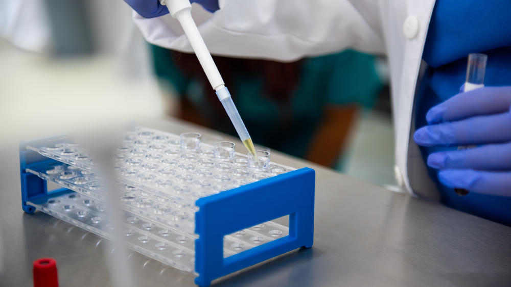 Preliminary results from a study show that gene-editing technology can be used to successfully treat a genetic disorder that increases the risk of heart disease.