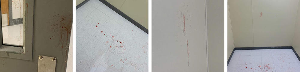 Portions of photos sent to Michelle Staten from an official at her son's former elementary school. The images show blood splattered across a small, bare-walled seclusion room where, Staten said, her son repeatedly punched himself in the face in 2019.