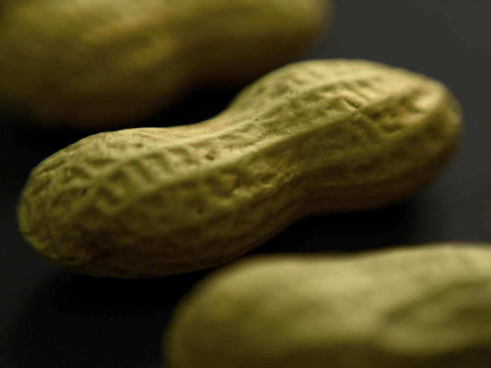 About 4.6 million adults in the U.S. have a peanut allergy, according to a study published by the <em>Journal of Allergy and Clinical Immunology</em> in 2021.