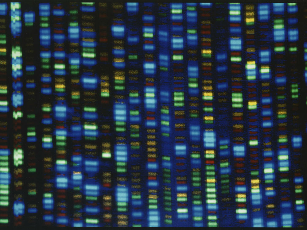 Results from a DNA sequencer used in the Human Genome Project.