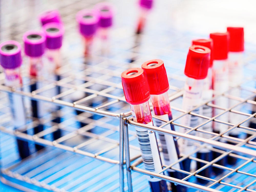 If the FDA approves it, a new blood test could become another screening option for colorectal cancer.