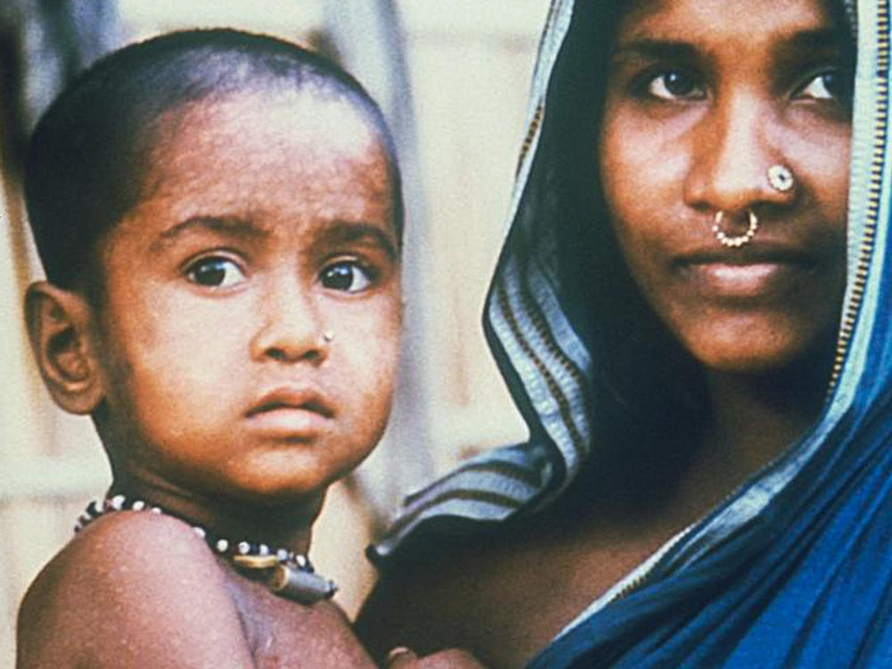 Rahima Banu had the last recorded case of naturally occurring variola major smallpox, a deadly strain of the virus, in 1975. At left: Banu in her mother's arms as a small child. At right: Banu today, close to 50 years old, lives in a small village in Bangladesh with her husband, Rafiqul Islam, and their children.