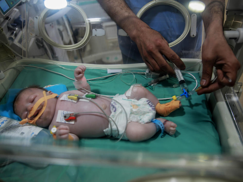 A baby is looked after at the neonatal unit at Kamal Adhwan hospital in Beit Lahia in the Gaza Strip, where children are born with complications due to malnourished mothers.