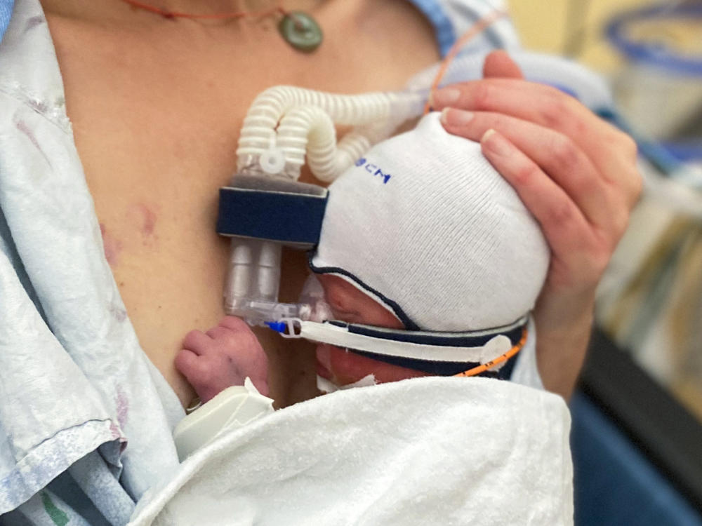 Tammy Myers holds her newborn son, Eames, during her premature twins' NICU stay. The Myers had to spend nearly two years legally adopting their biological twins, due to Michigan laws.
