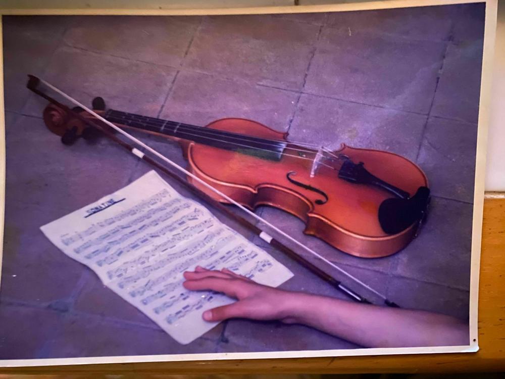 A photo of 10-year-old Ameen Mokdad's hand, which his father asked to use as a model for painting 