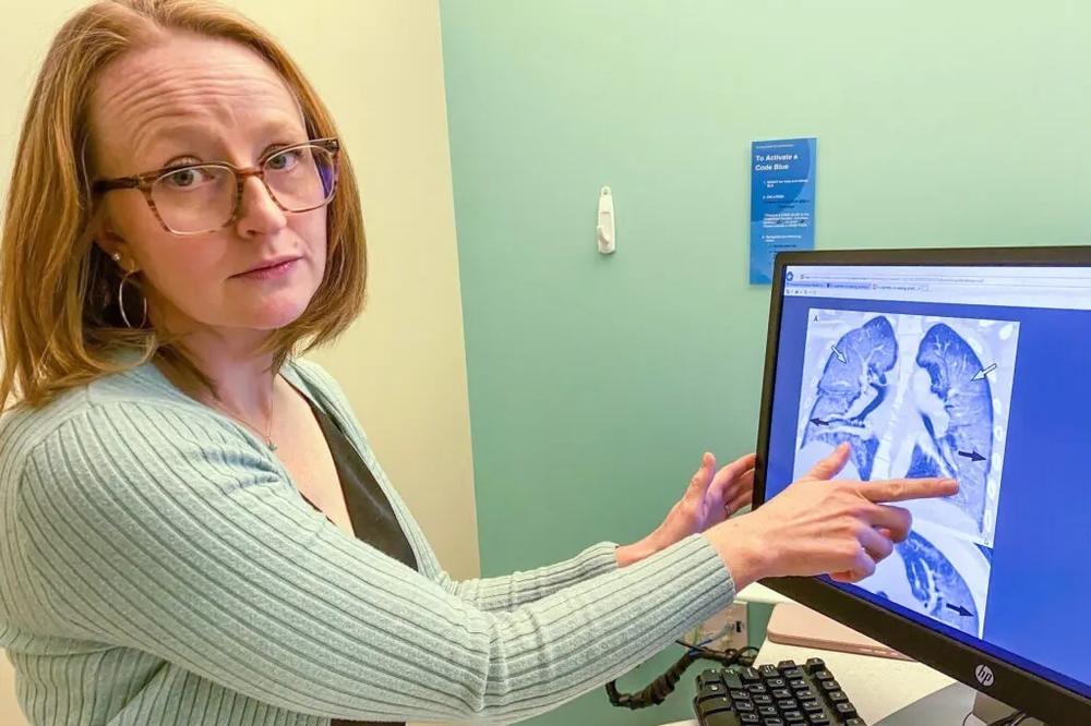 Dr. Heather De Keyser, pediatric pulmonologist at Children's Hospital Colorado, points to the X-ray of a lung of a young adult damaged by vaping.